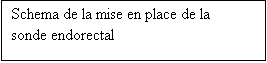 Zone de Texte: Schema de la mise en place de la sonde endorectal